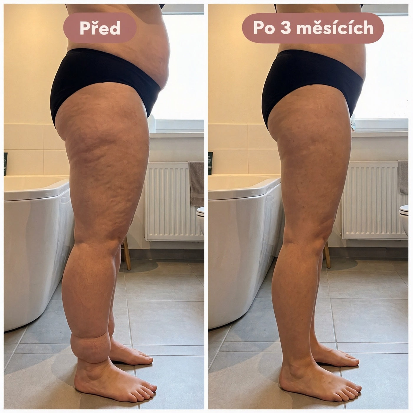 Před / po 3 měsících