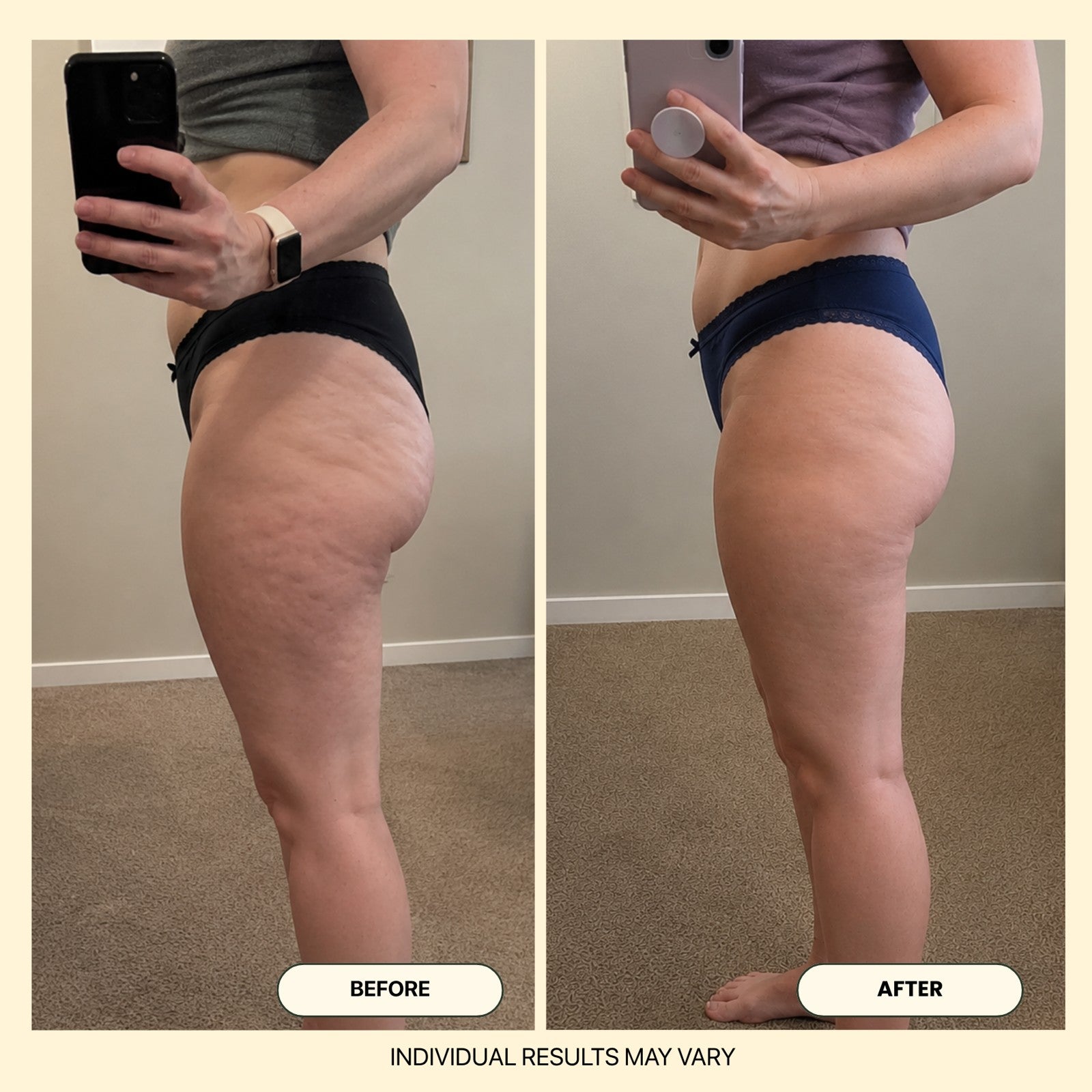Kakiya Anti-Cellulite Massage Oil