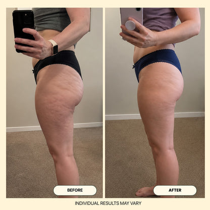 Kakiya Anti-Cellulite Massage Oil