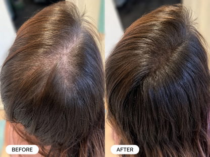 Kakiya Repair Spray — Eliminates Thinning Hair