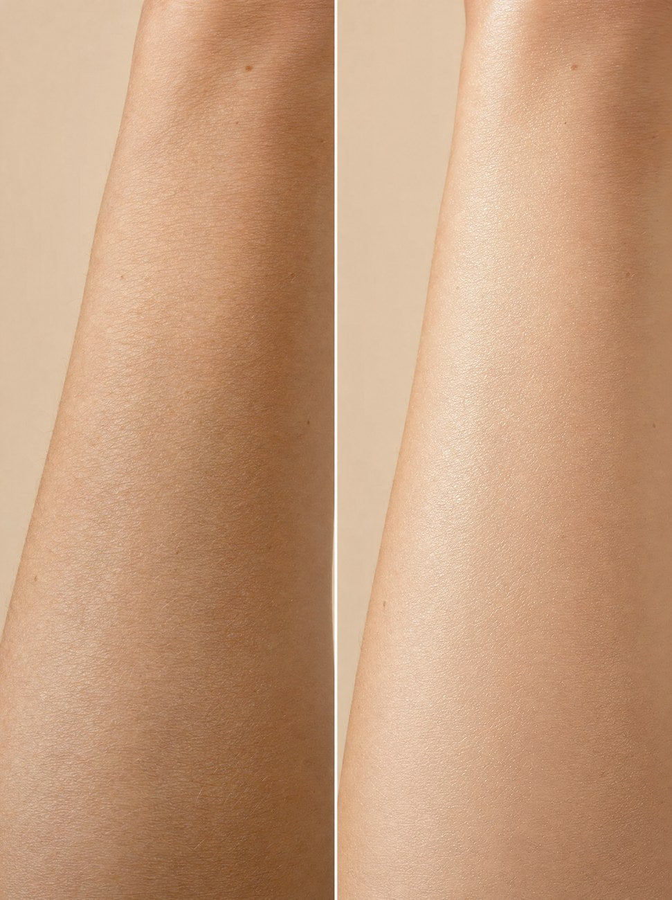 Before and after