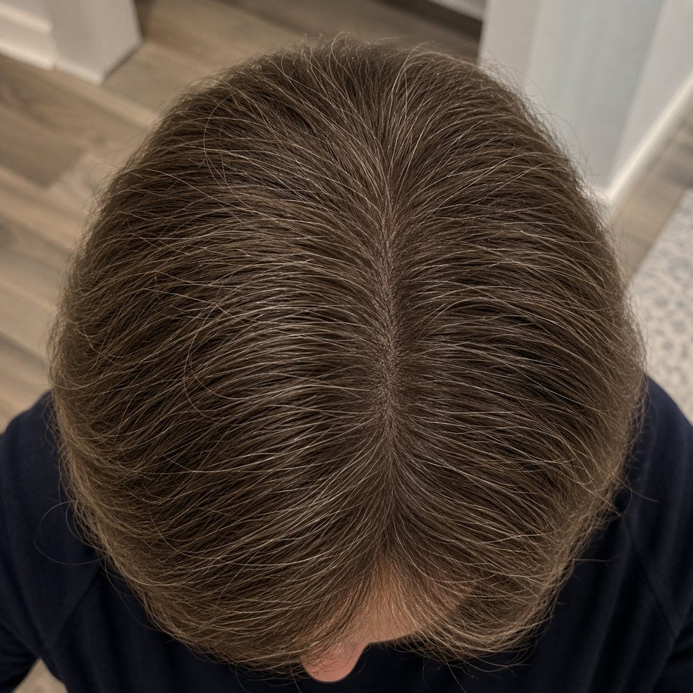 Crown after