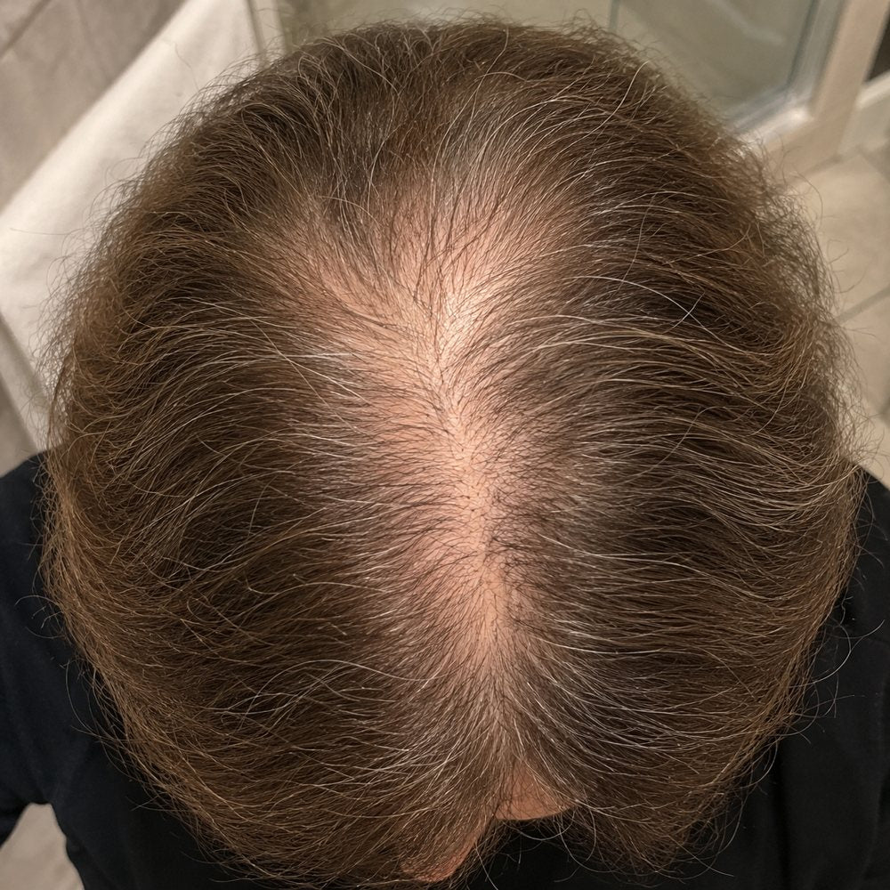 Crown before