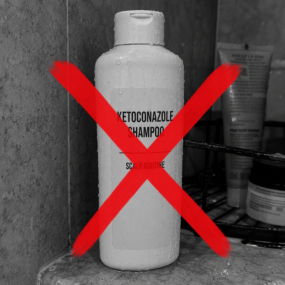 Ketoconazole shampoo